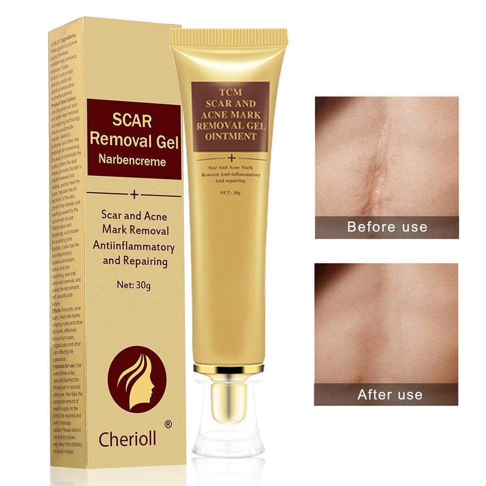 Best Filler For Acne Scars - Top 5 Detailed Reviews 